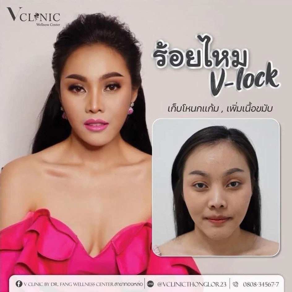 thread-lock-review