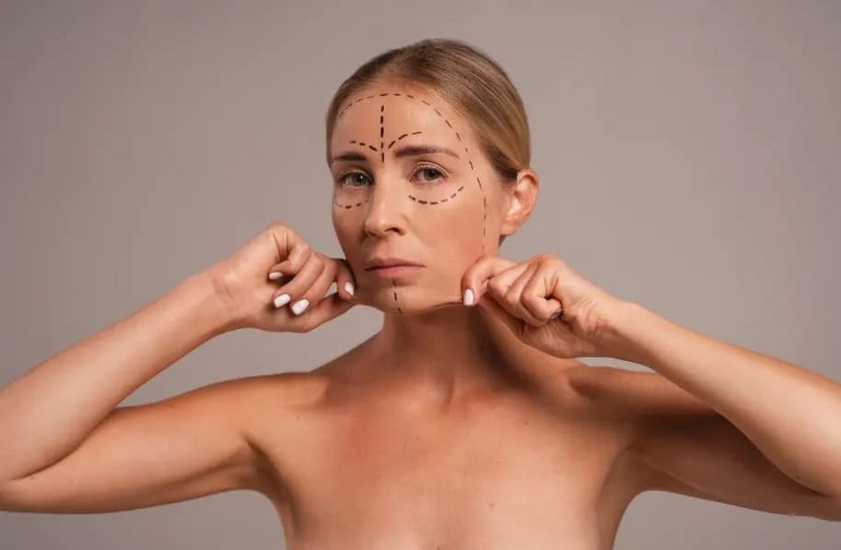 threadlift-benefits