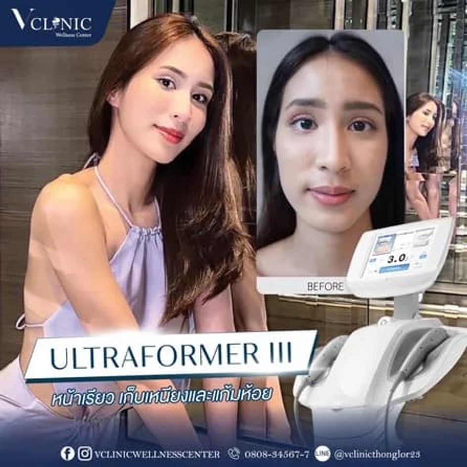 ultraformer-iii-review